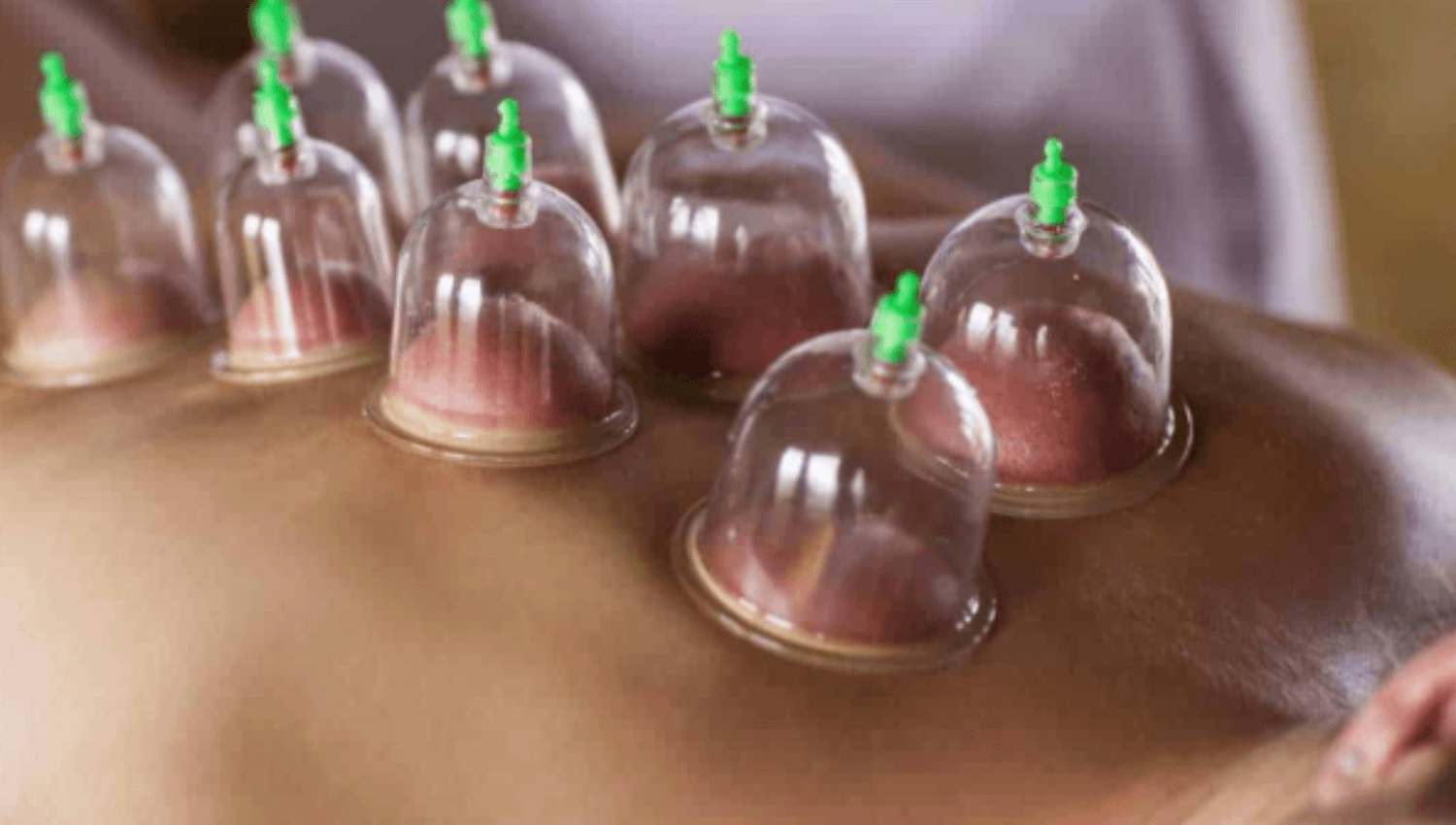Image for 60 min massage + cupping