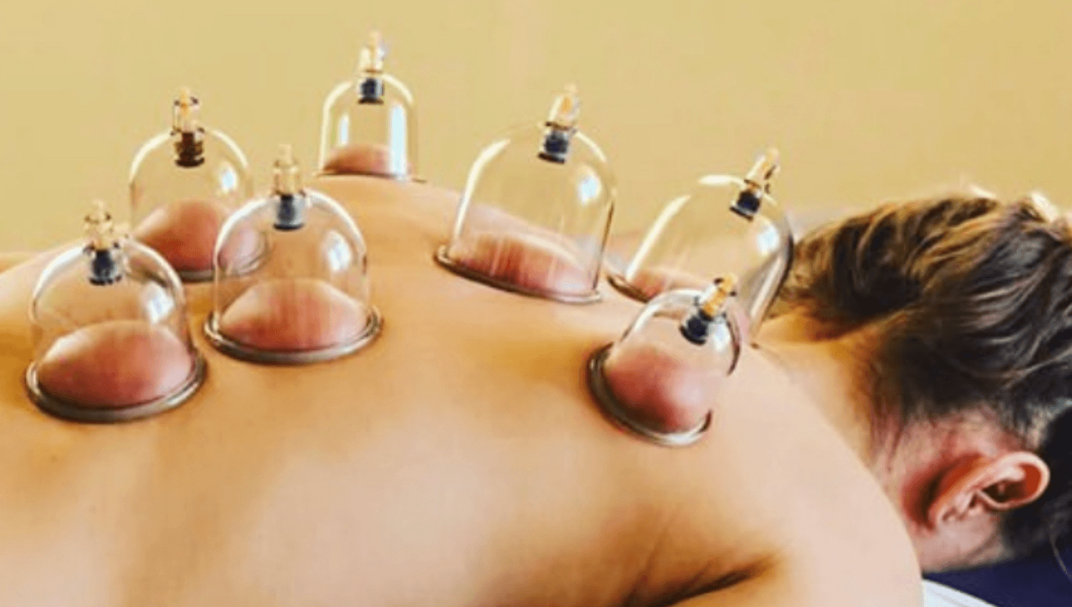 Image for 90 min massage + cupping